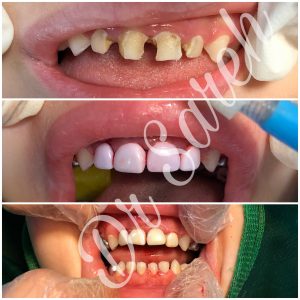 بهترین دندانپزشک کودکان کرج