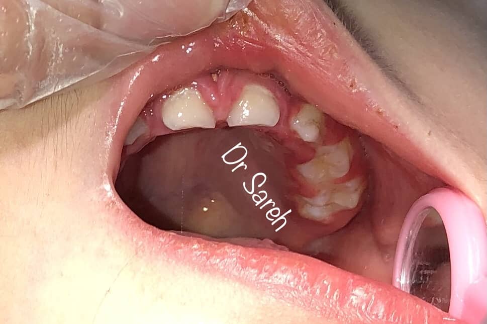 بیماری های دهان و دندان