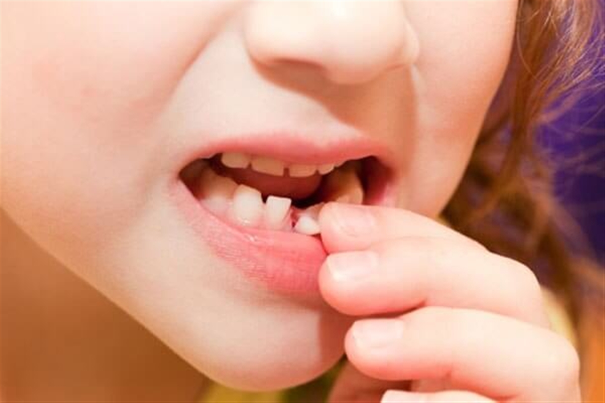 تشخیص دندان شیری از اصلی