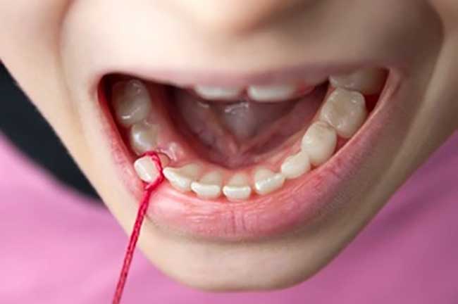 extraction-children-teeth-3