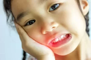 مراقبت های بعد کشیدن دندان کودک