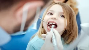 ایمپلنت دندان کودکان زیر 15 سال