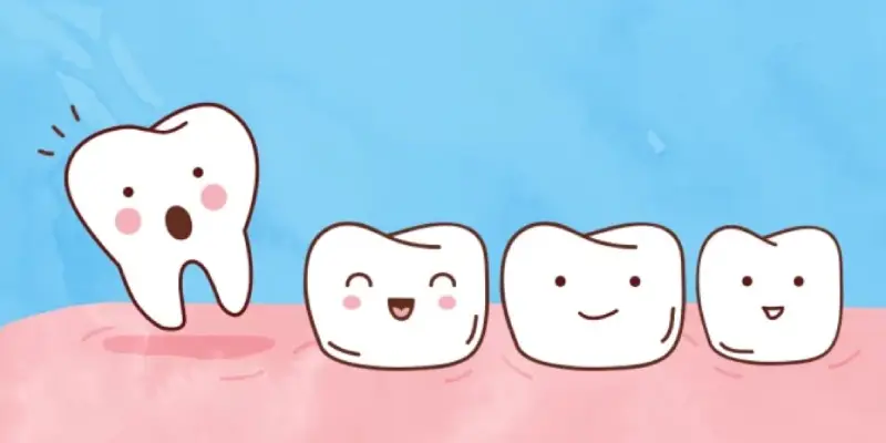 باقی ماندن ریشه دندان شیری در لثه