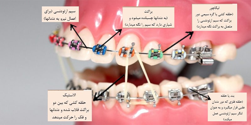 اصطلاحات ارتودنسی